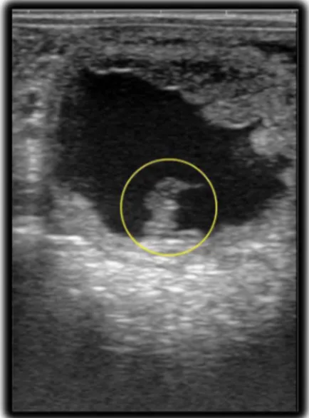 Fig. 11 – Embrião na região ventral da vesícula com 21 dias 