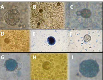 Figura 7.   Folículos pré-antrais corados com azul trypan, viáveis (A,B,C,D,F,H) e inviáveis  (E,G,I); com vários aumentos no  microscópio invertido.