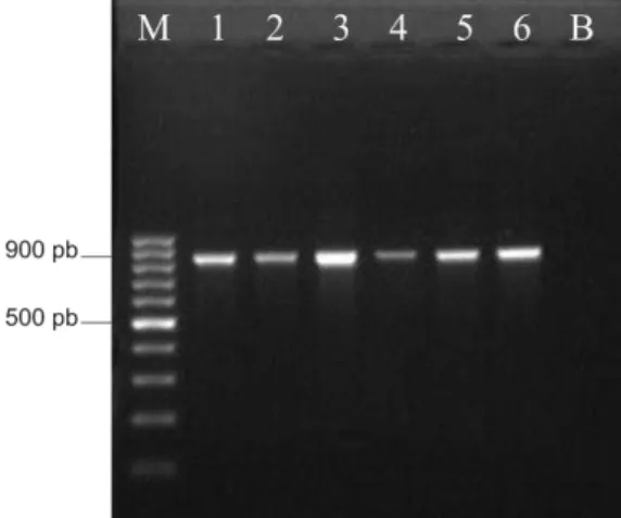 Figura 2  – Eletroforese em gel de agarose 1,5 % dos produtos de PCR para detecção  de  P