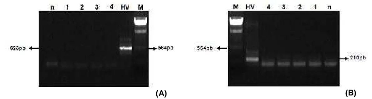 Figura 1: Eletroforese em gel de agarose 1,2% do produto de amplificação por PCR  dos fragmentos dos rDNAs 26S de fungos, e dos rDNAs 16S de bactérias  e  arqueas