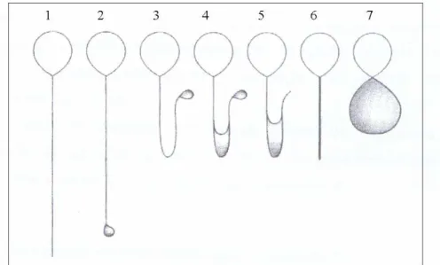 Figura 1: Dobramento de cauda espermática observados na avaliação do teste  Hiposmótico: 1 célula não reativa; 2 a 7 células reativas ao teste