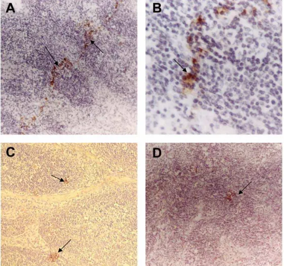 Figura 4 – Resultados do Teste de Imunoperoxidase Indireta (Ipx) para detecção da  fenotipagem celular em cortes de linfonodos de bovinos inoculados com a  amostra de Anaplasma marginale AUFV1, seis dias após a inoculação