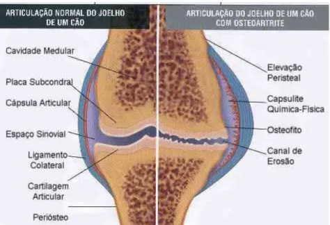 Figura 1: Anatomia normal (à esquerda) e alterações patológicas  associadas com a osteoartrite (à direita) da articulação  do joelho de um cão