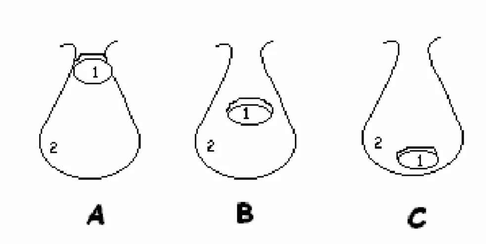 Figura 1 – Esquema dos critérios adotados para a verificação da posição do  testículo (1) na região do escroto (2)
