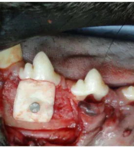 Figura  4:  Posicionamento  da  membrana  composta  por  Hidroxiapatita  (HAP  91 Plus®) e policaprolactona, fixada por parafuso de alumínio; sobre defeito  ósseo realizado sobre o 4º pré molar inferior