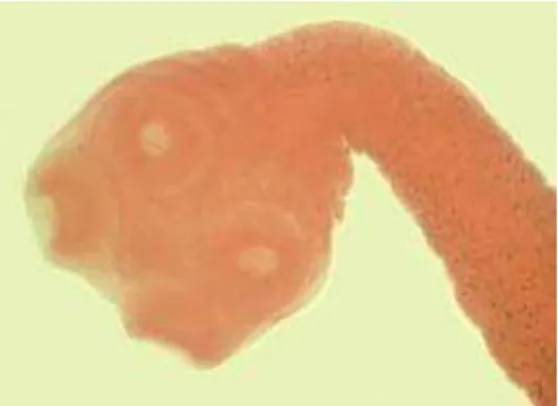 Figura 1.  Escólex da T. solium (Fonte: CDC,  2013a). 