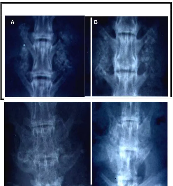 Figura 5. Aspectos radiográficos da área de enxertia: (A) após a cirurgia, (B) às cinco  semanas, (C) às 7 semanas e às 9 semanas (união óssea bilateral)
