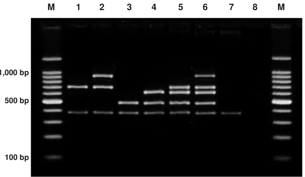 Figure 1. Multiplex PCR profiles for serotyping of Listeria spp. strains included in the  present study, demonstrating the distinct combination of amplification products for  prs  (370 bp), ORF2819 (471 bp), ORF2110 (597 bp), lmo0737 (691 bp), and lmo1118 