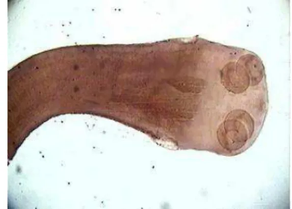 Figura 2. Escólex da Taenia solium          Figura 3. Escólex da Taenia saginata  Notar coroa de acúleos                              Fonte: UFRGS (2010) 