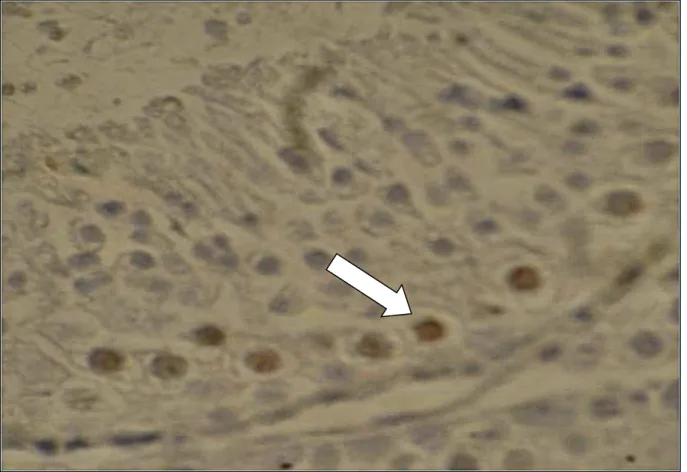 Figura  04-  Fotomicrografia  da  lâmina  histológica  evidenciando  a  marcação  da  bromodeoxiuridina em núcleos de espermatócitos primários em paquíteno no estádio  VI do ciclo do epitélio seminífero de quati