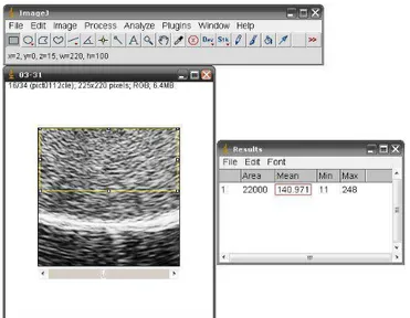 Figura 2: Análise de imagens por meio do programa ImageJ ® . 