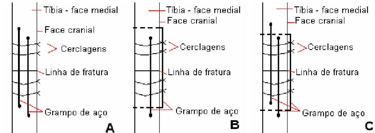 Figura 2: Desenho esquemático da forma de fixação experimental de fratura tibial e fibular, utilizando 