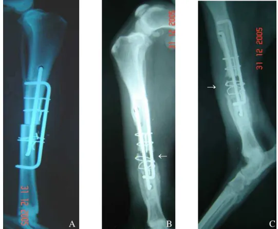 Figura 3: Projeções radiográficas para avaliação dos tratamentos de fratura tibial e fibular em cão, 