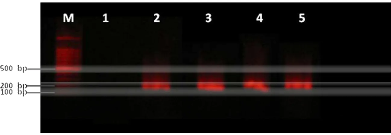 Figura 1. Produto da  Nested -PCR em gel de agarose a 1%, de COCs de vacas  soropositivas para o BoHV1 (M: marcador; 1: controle negativo; 2: controle  positivo; 3, 4 e 5: Amostras de COCs positivas)