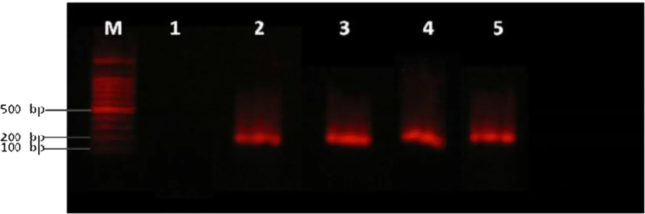 Figura 1. Produto da  Nested -PCR em gel de agarose a 1%, para COCs de  vacas soropositivas para o BoHV1 (M: marcador; 1: controle negativo; 2:  controle positivo; 3, 4 e 5: Amostras de COCs positivas)