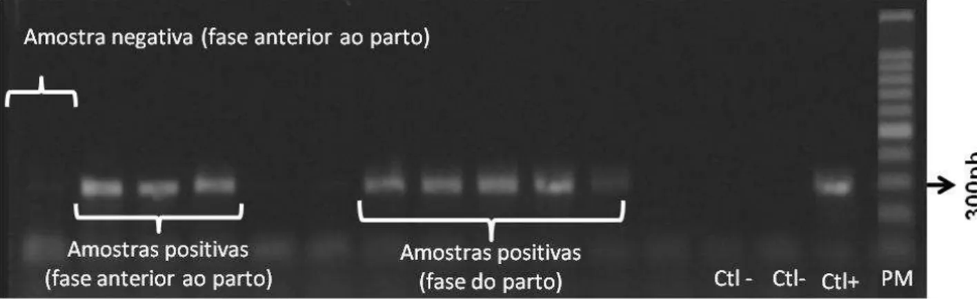 Figura 8. Ilustração de reação interna de algumas amostras de leite coletadas na fase do parto e em  5 meses pré-parto