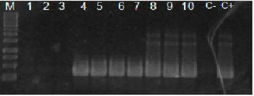 Figura 10  – Eletroforese em gel de agarose de produtos de Nested PCR .  M: marcador de tamanho  molecular (Promega, USA)