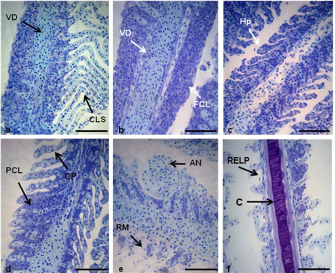Figura  6:  Alterações  histológicas  nas  brânquias  de  fêmeas  maduras  de  lambaris  A