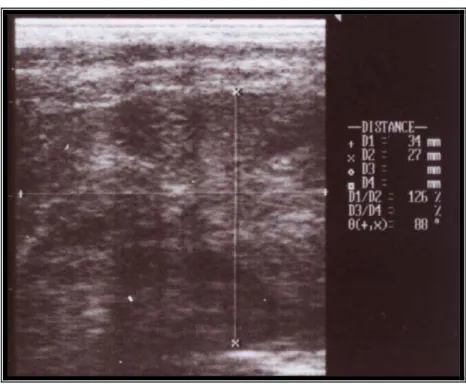 Figura 2. Imagem ultra-sonográfica transversal da próstata de cão com 