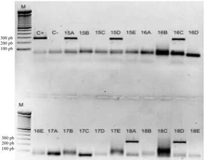 Figura 3. Ilustração da reação da PCR, utilizando as amostras positivas (15A, 15D, 16C,  18A e 18D) e negativas (15B, 15C, 15E, 16A, 16B, 16D, 16E, 17A, 17B, 17C, 17D,  17E, 18B, 18C e 18E), o marcador (M) de 100 pb (GIBCOBRL), um controle positivo  de Sal