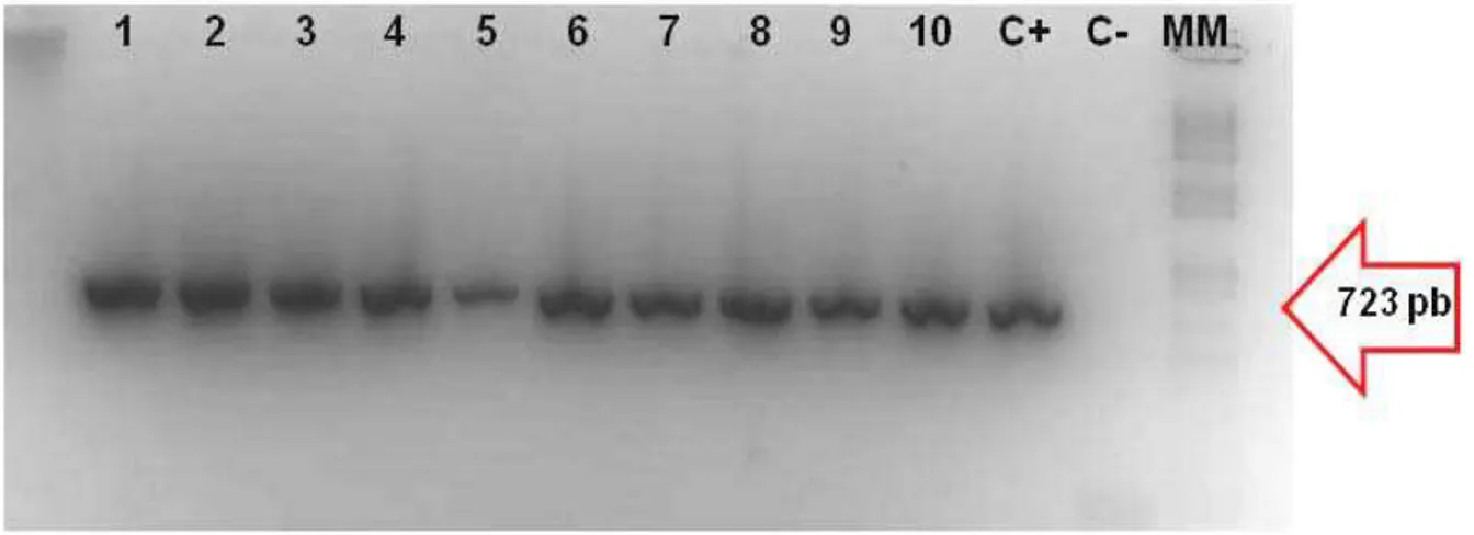 Figura 4 – Isolamento do fragmento de 723pb do gene  apx IA de  Actinobacillus  pleuropneumoniae , utilizando os primers ApxIA F/ ApxIA R