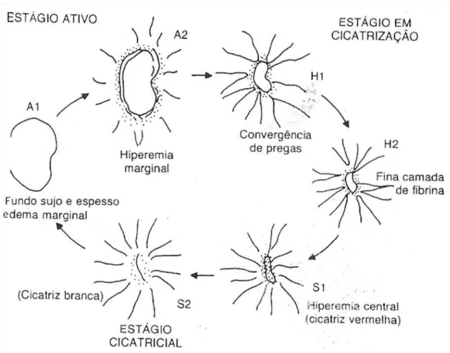 FIGURA 13  – Ciclo evolutivo da úlcera péptica. Fonte: adaptado de SAKITA, T.  (1973)