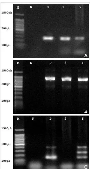 Figura 4: Eletroforese em gel de agarose de produtos de PCR para detecção de gene de nisina.   As figuras A, B e C referem‐se respectivamente a amplificação de nisina de acordo com García‐ Almendárez  et  al  (2008),  Rodríguez  et  al  (1995),  e  Espeche