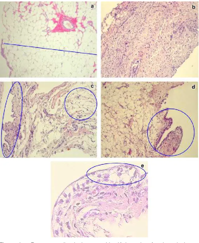 Figura 2  – Representação de imagens histológicas da cápsula articular. a:  animal do G1, cápsula normal com grande quantidade de tecido adiposo (traço  azul); b: animal do G2, substituição do tecido adiposo por tecido conjuntivo  fibroso; c: animal do G3,