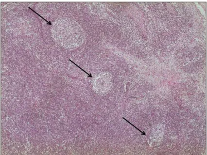 Figura 4. Fotomicrografia de linfonodo inguinal de suíno 