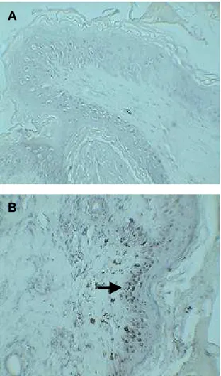 Figura 4:   Pele de cão do grupo III, não infectado (A); pele de cão do grupo I, cão  sintomático, mostrando a detecção de amastigotas de Leishmania no interior  de macrófagos, Imunoperoxidase indireta, 200X