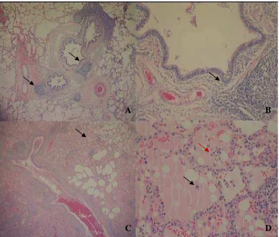 Figura 4 - A: Infiltrado linfocitário peribronquiolar com formação de centros germinativos  (coloração por hematoxilina e eosina aumento de 4 vezes)