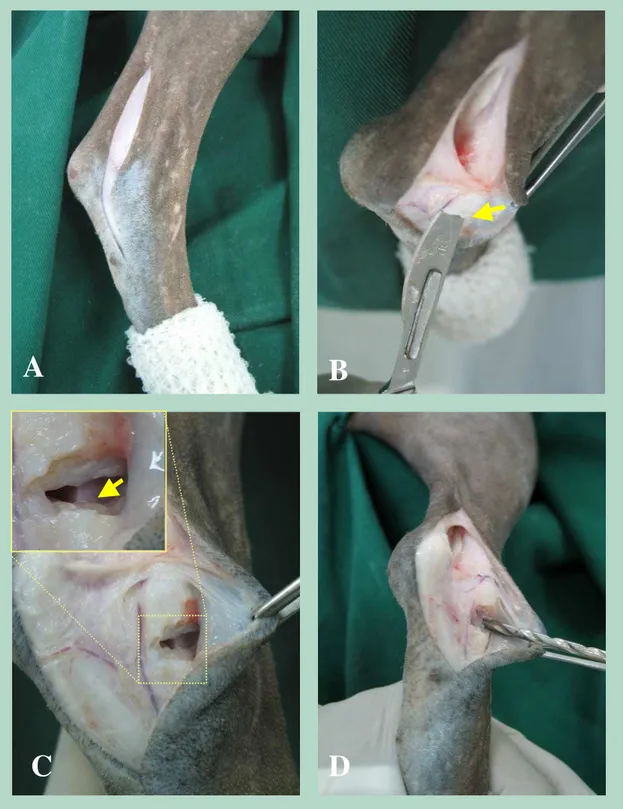 Figura 1 – Acesso cirúrgico, exposição e preparação das superfícies articulares para posterior imobilização da  articulação tibiotársica