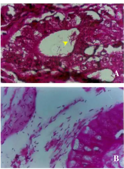 Figura 4: A- Fotomicrografias de mucosa gástrica mostrando bactérias  espiraladas do gênero Helicobacter (seta)  no lúmen das glândulas gástricas  B - Fotomicrografias de mucosa gástrica mostrando bactérias espiraladas do  gênero  Helicobacter  no muco sob