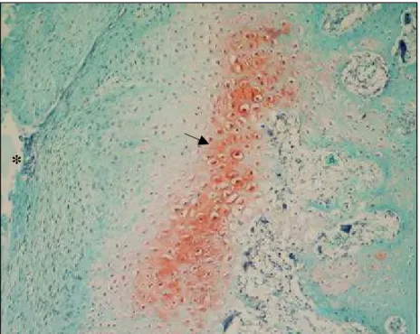 FIGURA 4  -  Cartilagem hialina (seta) no fundo da falha, em um animal do subgrupo  T4, aos 60 dias de pós-operatório