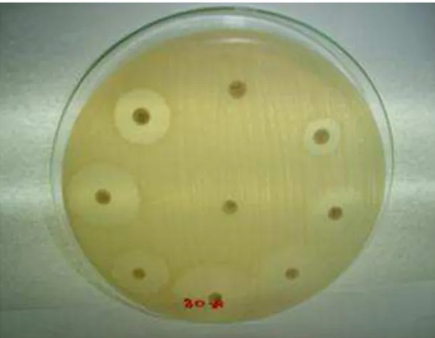 Figura 9. Cepa de Escherichia  coli ATCC  25922 em Ágar Muller Hinton. Controle de  medida dos halos