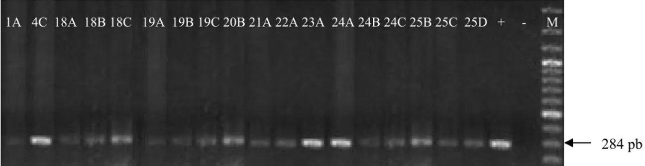 Figura 1. Gel de eletroforose com produtos de amplificação obtidos pela Reação em Cadeia  da Polimerase (PCR) de caldos de pré-enriquecimento semeados com amostras superficiais de  carcaças de frangos, antes (1A e 22A) e após (4C, 18A, 18B, 18C, 19A, 19B, 