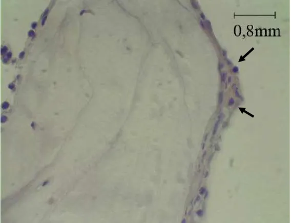 Figura  10:  Fotomicrografia  da  Imunoisto-química  de  um  macho  do  grupo  castrado