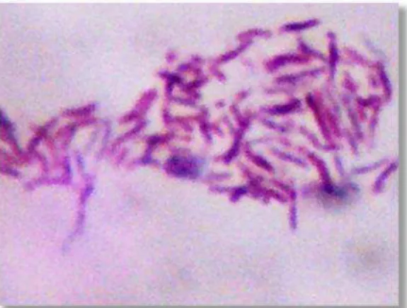 Figura 1. Esfregaço de cultura de  Mycobacterium avium subesp. paratuberculosis