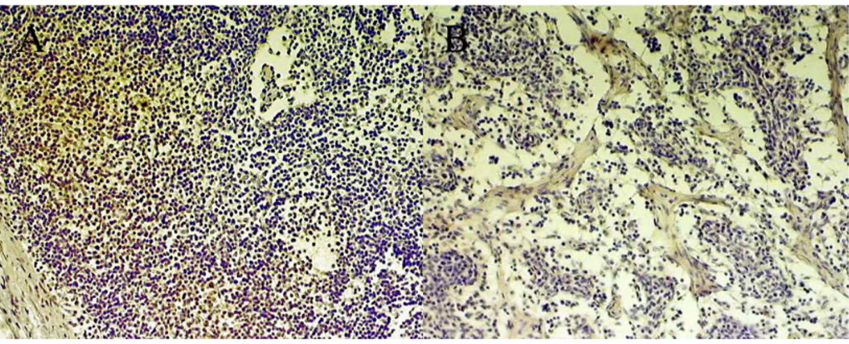 Figura 8 – Linfonodos bovinos submetidos à técnica imunohistoquímica  imunoperoxidase para expressão de HSP70 e HSP90