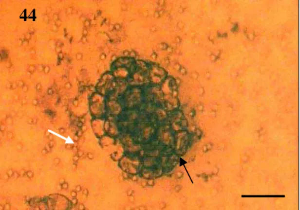Figura 44 – Hifa de Paecilomyces lilacinus (seta branca) e cápsulas ovígeras de Dipylidium  caninum (seta preta), demonstrando o efeito do tipo 1
