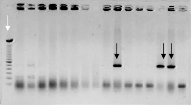 Figura 8.  Gel de agarose 0,8% da PCR de 16 colônias transformadas. As setas em preto 
