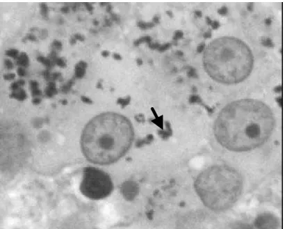 Figura 3. Células de Leydig de jaguatirica adulta, com pigmentos de lipofuccina (seta) em  seu citoplasma