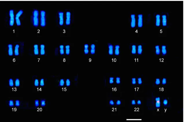 Figura 5: Cariograma humano de um indivíduo do sexo masculino. Marcação do cromossomo 