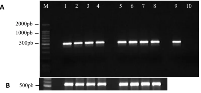 Figura 10. Análise do RT-PCR do gene que codifica subunidade seis de  ATP sintase  (A)  e subunidade ribossomal 17S (B)