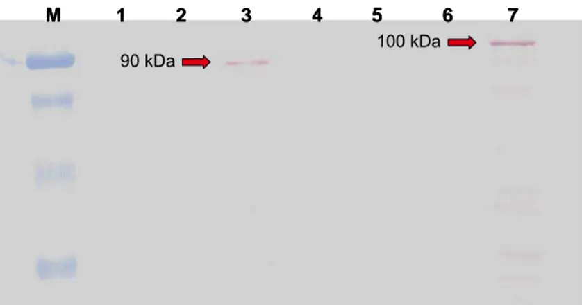 Figura 5. Detecção da expressão das proteínas quiméricas  BD+NBS+LRR (canaleta 3 – aproximadamente 90kDa) e  BD+CC+NBS (canaleta 7 – aproximadamente 100kDa) em  levedura, por meio da análise de  Western blotting 