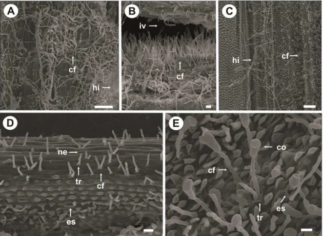 Figura 4: Fotomicroscopia eletrônica de varredura da superfície foliar de folhas  de  gladíolo  suscetível  (A,  B)  e  resistente  (C-E)  192  horas  após  a  inoculação  com  Curvularia  gladioli