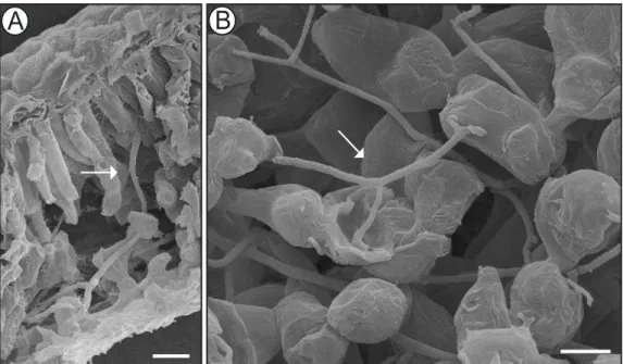 Figura  7.  .  Eletromicrografias  de  varredura  da  colonização  de  Botrytis  cinerea  em  folhas  de  eucalipto  urograndis  às  120  horas  após 