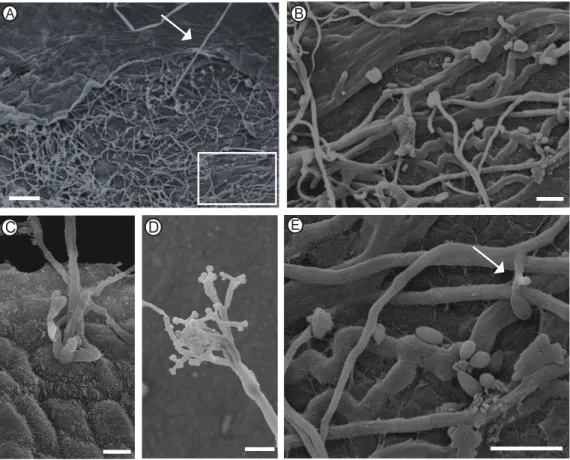 Figura 8. Eletromicrografias de varredura dos aspectos da reprodução  de Botrytis cinerea em folhas de eucalipto urograndis (clone CNB 011)