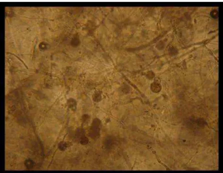 Figure 1. Oospores originated from crosses of Brazilian isolates of Phytophthora 
