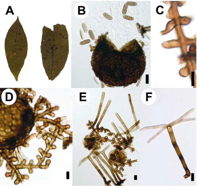 Figure  4.  Meliola  mutisiae  on  Mutisia  speciosa :   A.  Colonies  amphigenous;  B